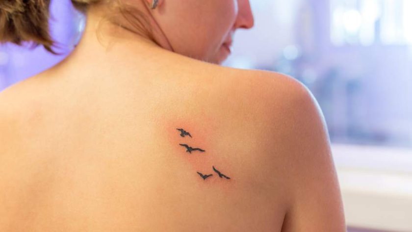 Quelles sont les solutions pour se faire retirer son tatouage