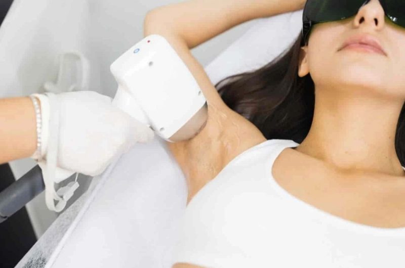 Mythe et réalités sur l’épilation laser Tout savoir en 2024