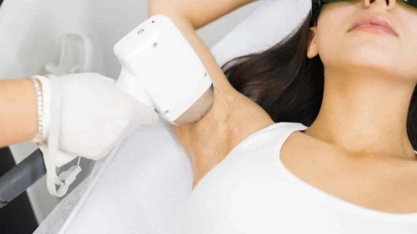 Mythe et réalités sur l’épilation laser Tout savoir en 2024