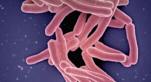 Comment améliorer naturellement son microbiote intestinal ?
